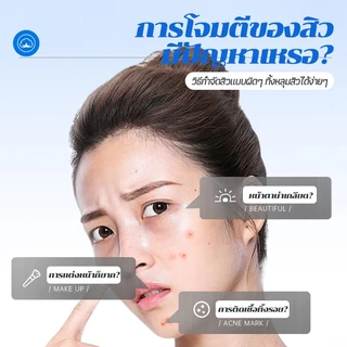 แผ่นสติกเกอร์แปะสิว แผ่นสิว สําหรับติดตกแต่งสิว แผ่นแปะดูดสิว แผ่นดูดสิว น่ารักแผ่นแปะสิว น่ารัก