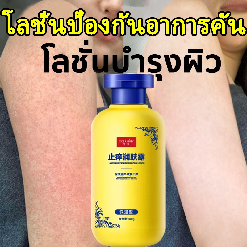 โลชั่นบำรุงผิวป้องกันอาการคัน โลชั่นบำรุงผิวช่วยเพิ่มผิวแห้งและลอก ให้ความชุ่มชื้น ชุ่มชื้นและฟื้นฟูผิว