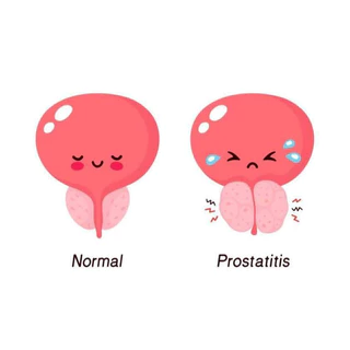 PROTOLITE ผลิตภํณฑ์เสริมอาหารต่อมลูกหมาก 1 กล่อง 20 แคปซูล