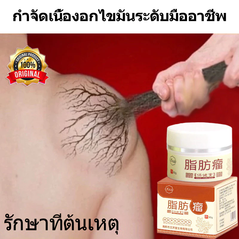 ก้อนเนื้อใต้ผิวหนัง ก้อนเนื้องอกไขมัน 30g กำจัดเนื้องอกไขมัน ก้อนเนื้อใต้ผิวหนัง