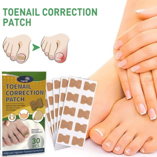 Toenail correction patch เทปกันเล็บขบนิ้วเท้า