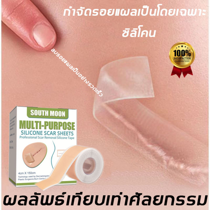 South Moon แผ่นปิดแผล แผ่นแผลเป็น แผ่นแปะแผลเป็น แปะแผลเป็น แปะแผล ลดแผลเป็น รอยแผลเป็น เผยผิวเนียนสวย