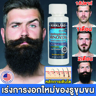 จัดส่งทันที Kirkland 5% kirkland hair minoxidil ของแท้แบบเดิม เซรัม ผมร่วง หัวล้าน ปลูกผม ปลูกหนวด เซรั่มบำรุงผม