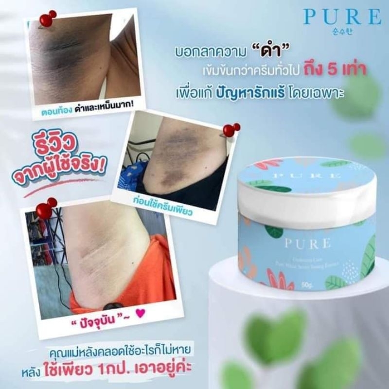 Pure ครีมทารักแร้ ขาหนีบ