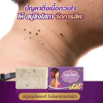 สบู่ขิงโสภา แพคเกจใหม่ :: ติ่งเนื้อหลุด ขี้ไคลหาย สูตรออแกนิค