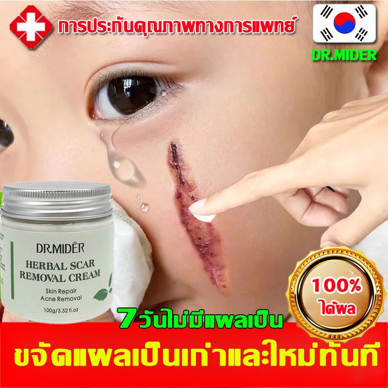 นำเข้าจากเกาหลี ครีมลดรอยแผลเป็น ลบรอยแผลเป็น รอยสิว  รอยแผลเป็น ลดรอยสิว รอยดำ ครีมลดรอยแผลเป็น 100 กรัม