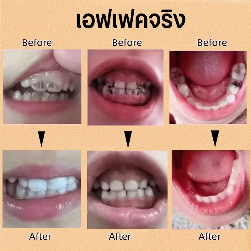สเปรย์สำหรับเด็ก ยาสีฟันเด็ก ยาสีฟันเด็กกลืนได้ 40ml สเปรย์ดูแลสุขภาพช่องปากและฟันสำหรับเด็ก ยาสีฟันทําความสะอาดช่องปาก