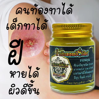 โปร 1 แถม 1 ซื้อเลย ชุดกำจัดฝีทุกชนิดครีมบาล์มและสบู่ ดูแลป้องกันเเละยับยั้งฝีหนอ งเนื้อครีมโลชั่นนุ่นเป็นมิตรต่อผิวหนัง