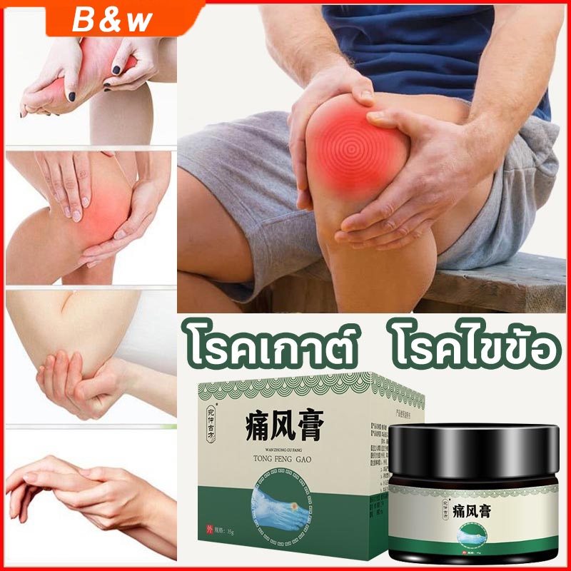 ครีมรักษาโรคเกาต์ ครีมบรรเทาอาการปวดข้อ ครีมสมุนไพรทาเกาต์ 35g แก้ปวดอย่างรวดเร็ว ลดอาการบวม อ่อนโยนปลอดภัย