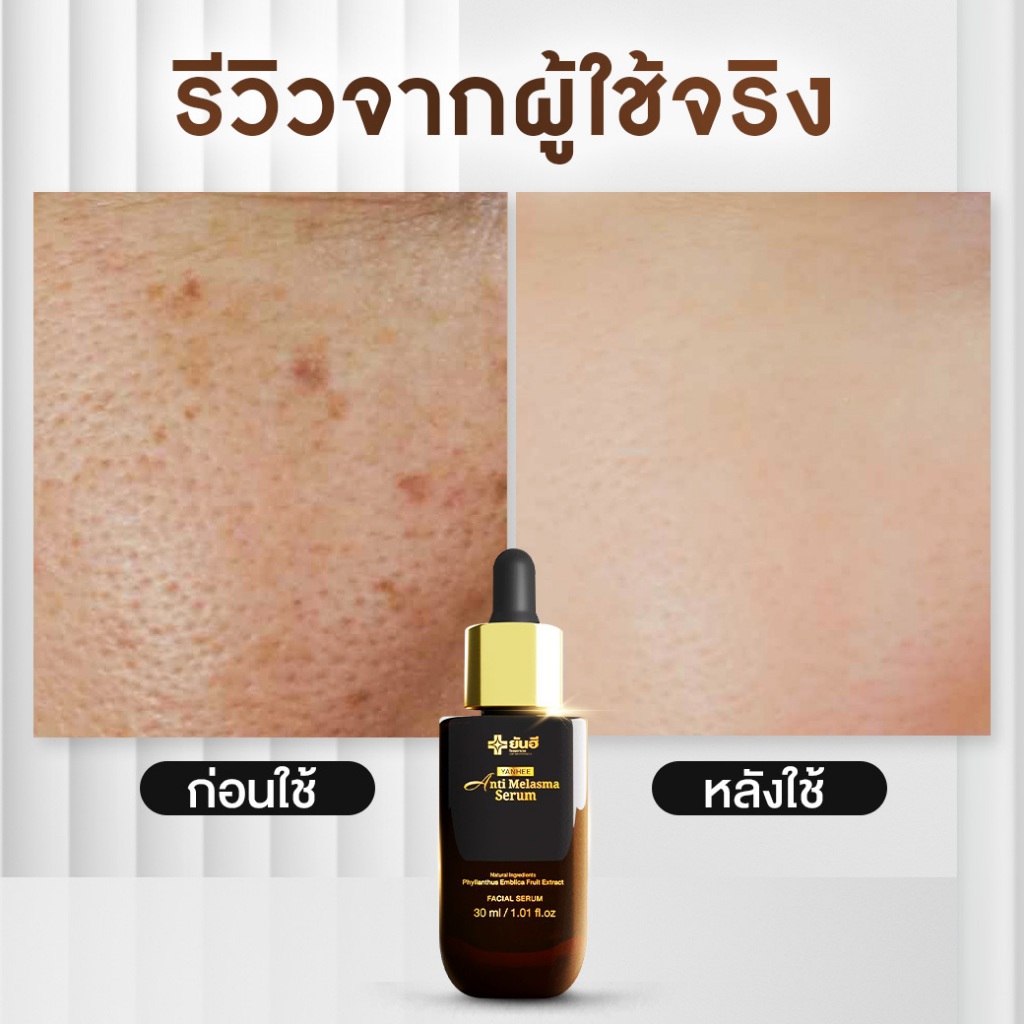 Yanhee Anti Melasma |ดำ 2 ขวด|  ยันฮี แอนตี้เมลาสม่า เซรั่ม จบปัญหา ฝ้า กระ จุดด่างดำ จากยันฮี ราคา ถูกที่สุด ดีลบีเคเค แกลเลอรีภาพที่ 6