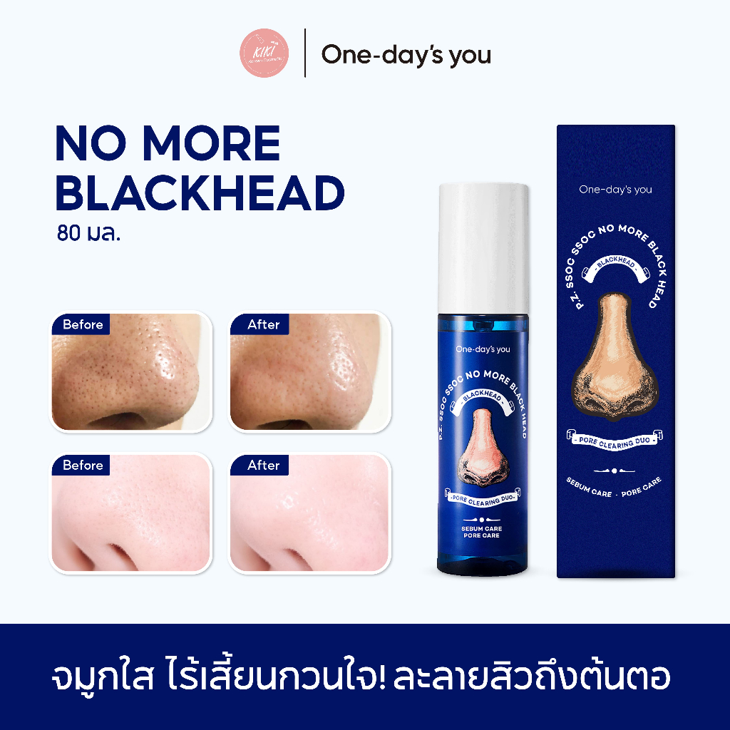 Clearance! เอสเซนส์ละลายสิวเสี้ยนที่จมูก ไม่ทำให้รูขุมขนกว้าง One Day's You P.Z SSOC SSOC NO MORE BLACKHEA