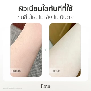 Parin เครื่องกำจัดขน IPL Gen3 Laser เครื่องกำจัดขน&หน้าใส (999,999 Shot) MultiFunction สี Black Gold (รับประกัน 1 ปี)