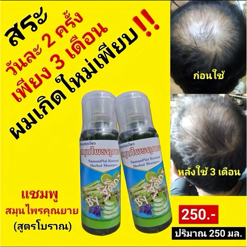 พร้อมส่ง แชมพูสมุนไพรคุณยาย 🐥 มีสมุนไพรไทย 17 ชนิด ช่วยลดผมร่วง บาง คัน เชื้อรา ผมขึ้นใหม่