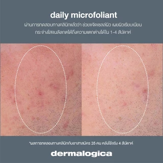 [ พร้อมส่ง ] [ สินค้าขายดี! ] Dermalogica Daily Microfoliant ขนาด 74 กรัม/ 13 กรัม ผงแป้งผลัดเซลล์ผิวแบบอ่อนโยน