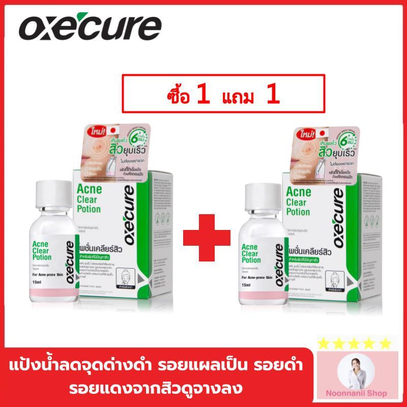 1แถม1 Oxe cure แต้มสิว แป้งน้ำชมพูลดสิว Acne Clear Potion 15 ml จากประเทศญี่ปุ่น