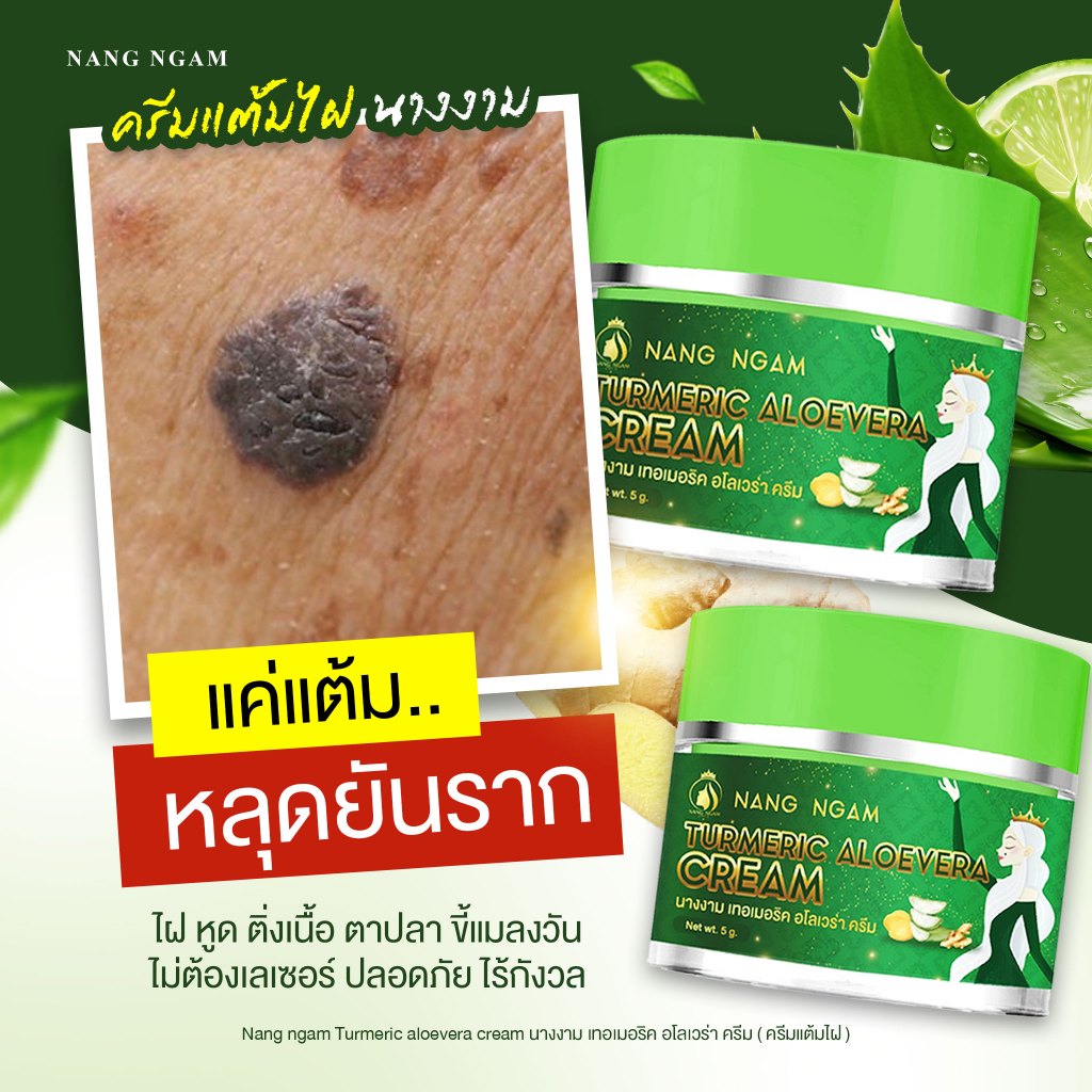 ครีมกำจัดไฝนางงาม ขี้แมลงวัน ติ่งเนื้อ หูด ตาปลา แก้ปัญหา กระ สิวหิน ครีมแต้มไฝนางงาม - รูปที่ 4