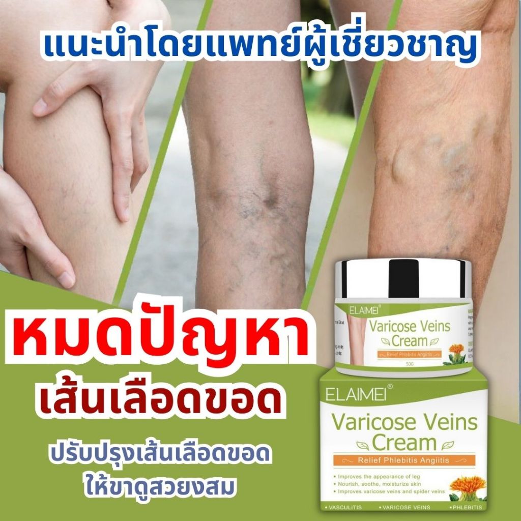 ELAMEIครีมทาเส้นเลือดขอด 50g ส่งเสริมการไหลเวียนเลือดบรรเทา ยาเส้นเลือดขอด ยาทาเส้นเลือดขอด