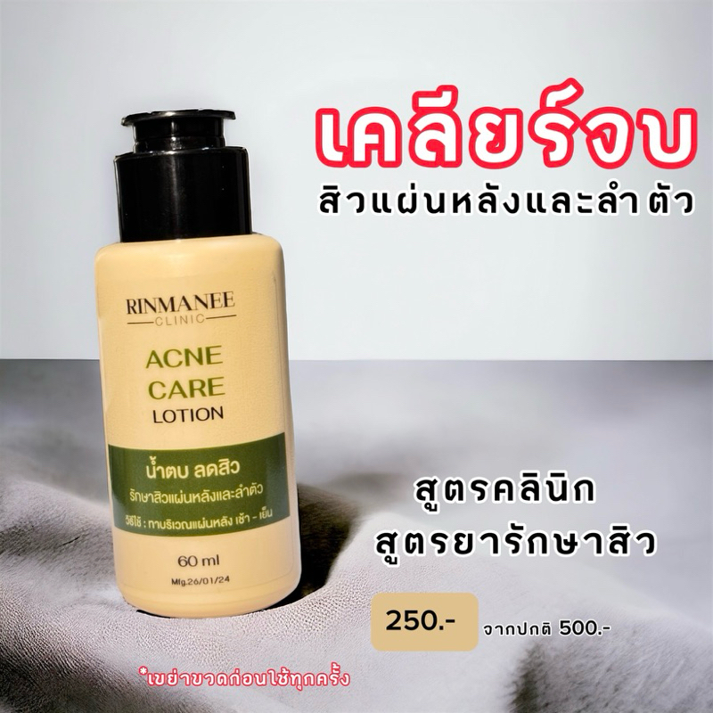 Acne Care lotion น้ำตบลดสิวที่หลัง สิวอก สิวลำตัว ฆ่าเชื้อสิว สิวยีสต์ เชื้อรา สเปรย์สิวที่หลัง ลดรอยดำ สูตรคลินิก