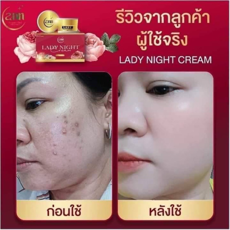 เชตครีมเชตหน้าใส เชต 2 ชิ้น เลดี้ไนท์ +วิตามินหน้าใส - รูปที่ 5