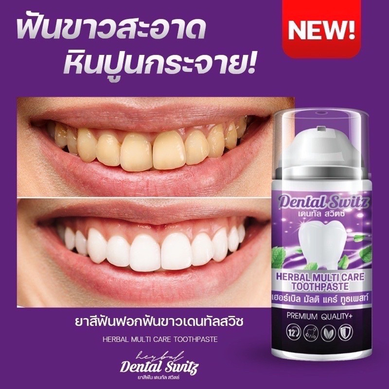 ยาสีฟันฟอกฟันขาวDentalswitz  เจลฟอกฟัน ลดกลิ่นปาก คราบหินปูน