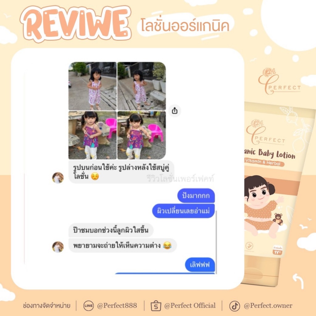PERFECT โลชั่นเด็กออร์แกนิค บำรุงผิวขาวกระจ่างใส แก้ขาลาย ลดรอยยุงกัด กู้ผิวคล้ำเสีย - 6