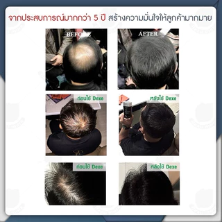 ผงเนื้อละเอียดมาก ผงโรยหัว ไฟเบอร์ ปิดผมบาง Dexe hair building fiber