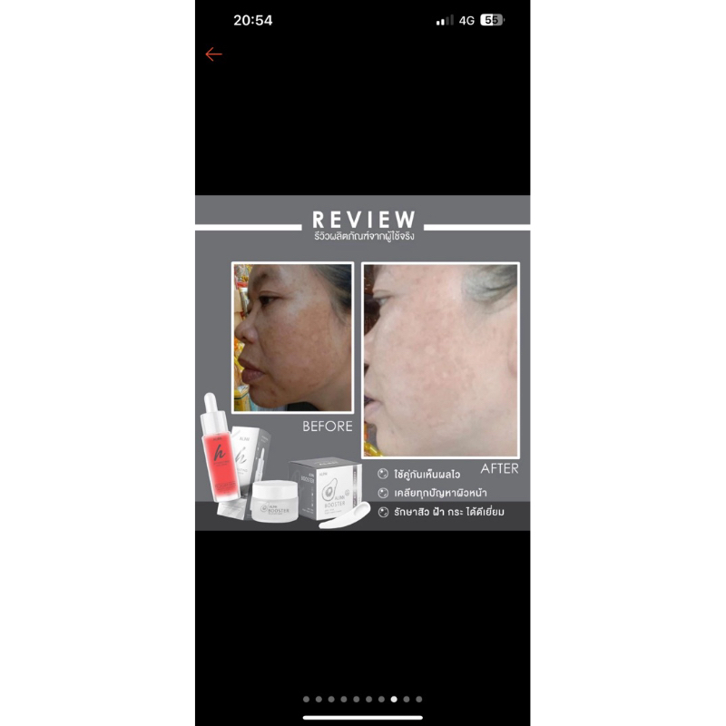 Alinbooster เซรั่มอลินบูทเตอร์ รูปที่ 6