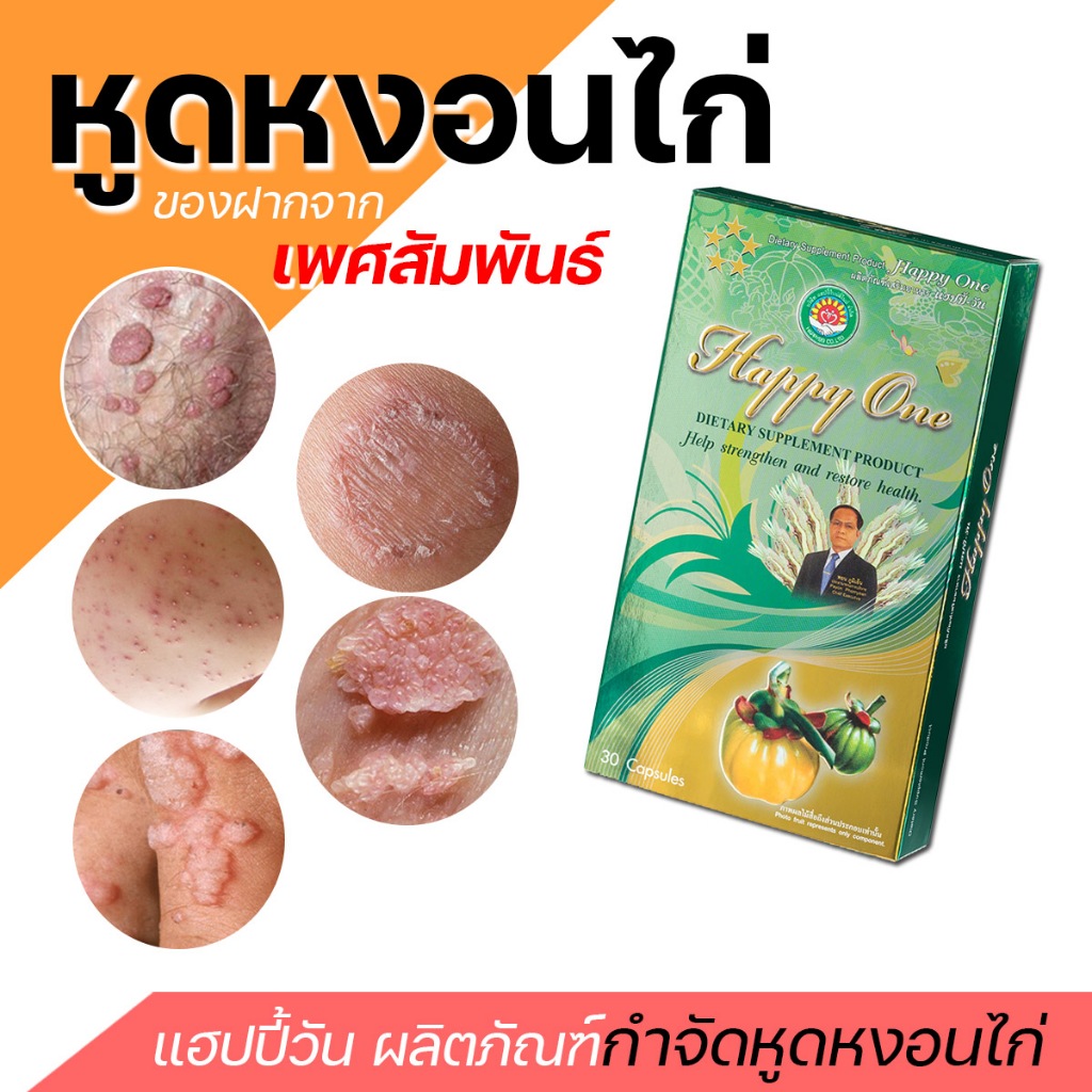 ผลิตภัณฑ์กำจัดหูด น้องชาย น้องสาว หูดหงอนไก่ ตราแฮปปี้วัน