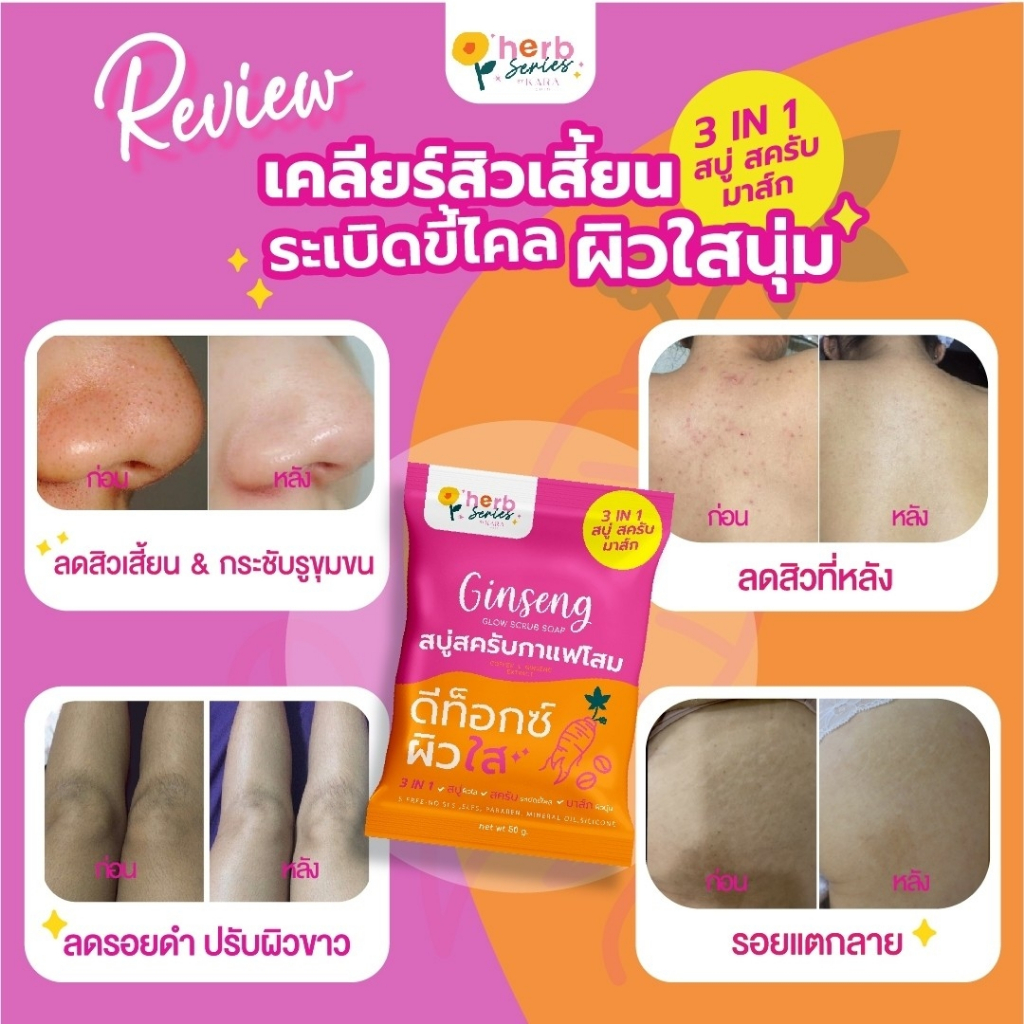 [โปรพิเศษ100กรัม-1แถม1] สบู่สครับกาแฟโสม จบปัญหาสิวฝ้า ผิวคล้ำเสียสะสม แก้รักแร้ดำ เข่าศอกด้าน