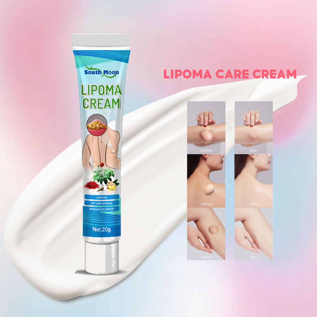 ครีมกำจัด lipatoma ครีมบำรุง Liposoma ก้อนไขมันแข็ง เนื้องอกไขมัน สมุนไพรกำจัด ก้อนเนื้อใต้ผิวหนัง ก้อนซีสต์