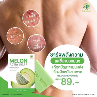 สบู่เมล่อน แอคน่า คัน เชื้อรา เกลื้อน70g.