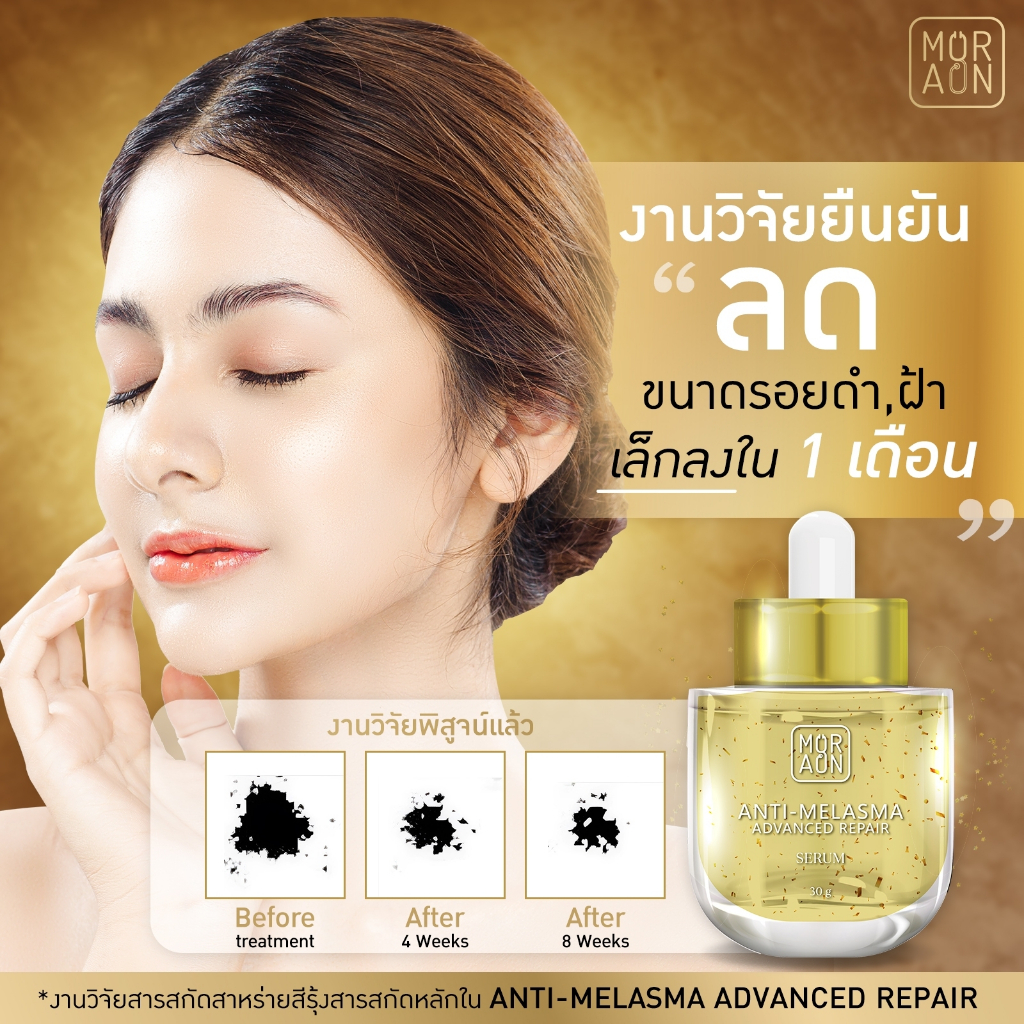 Anti-Melasma 30g สกินแคร์หมออ้น ลดเลือนฝ้า รอยดำ บำรุงผิว