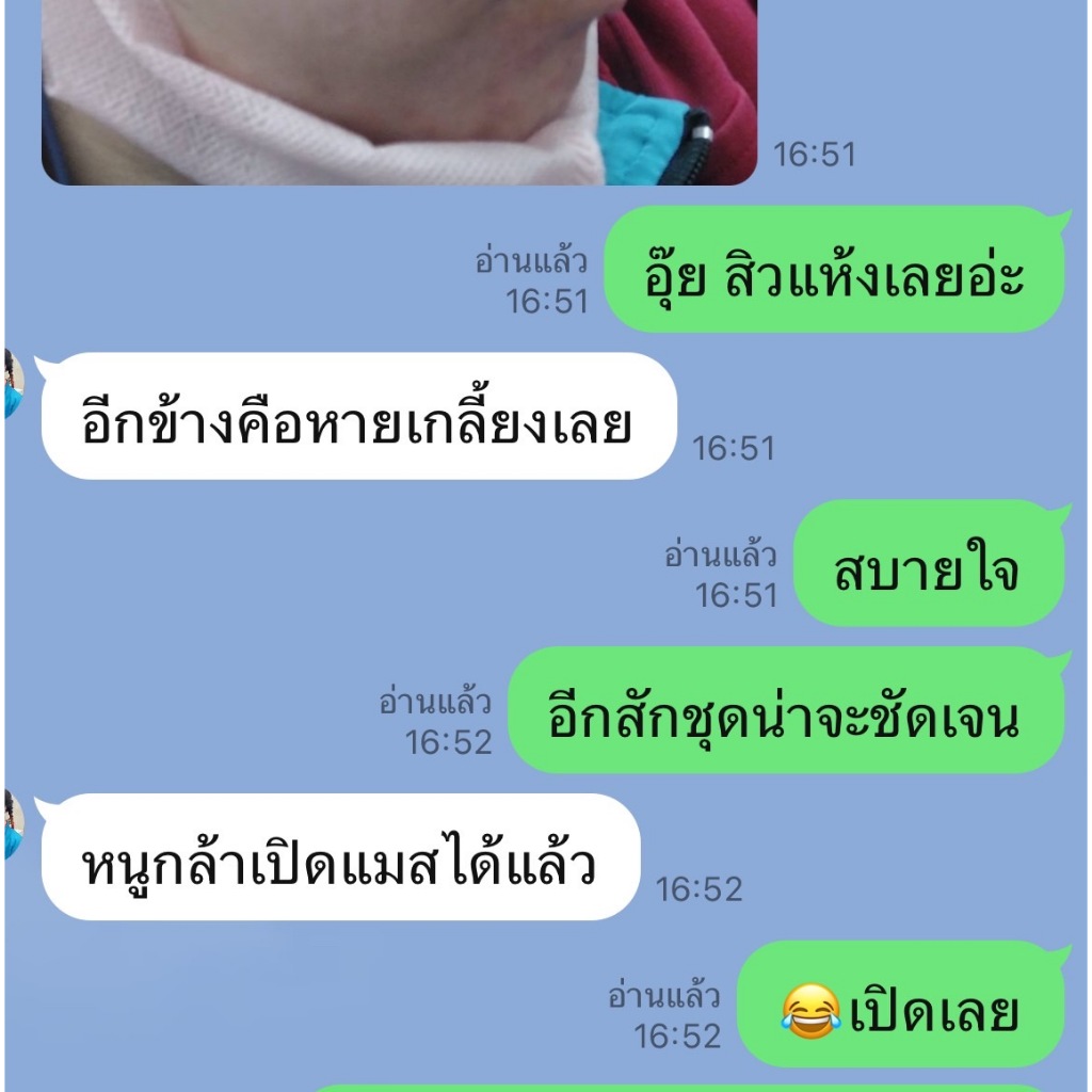 De Mind ครีมดีมายด์ ครีมแก้ฝ้าทาเช้าและก่อนนอน ขนาดทดลอง - รูปที่ 5