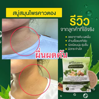 สบู่สมุนไพรคาวตอง ตรีเนตร ลดคัน ผื่น สะเก็ดเงิน ผิวอักเสบ สิว