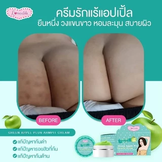 ครีมรักแร้แอปเปิ้ล ขนาด10กรัม
