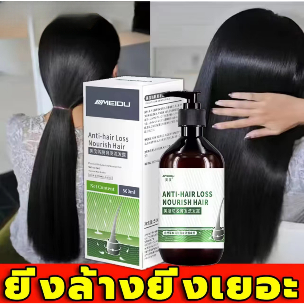 ปรับปรุงสภาพเส้นผม แชมพูแก้ผมร่วง 500ML บำรุงรากผม ปรับปรุงคุณภาพเส้นผม บำรุงผม แชมพูเร่งผมยาว ยาสระผมแก้ร่วง แชมพูลดผมร
