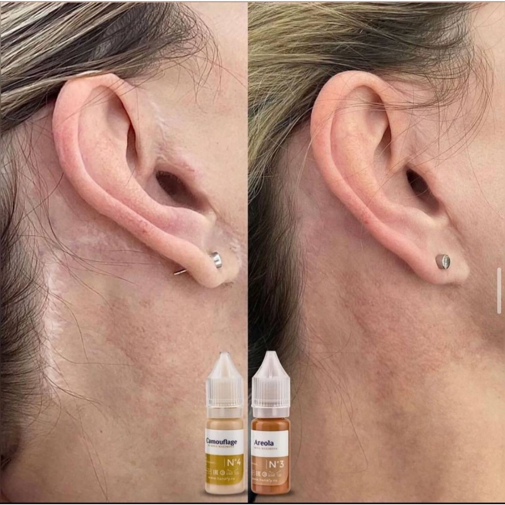 Hanafy Camouflage Areola Hanafy 10ml. สีนู๊ด สีเนื้อ ใช้ผสมเพิ่มความนู๊ด สีกลบรอยแตกลาย แก้จุดบกพร่องผิว สีรองพื้น สีกี
