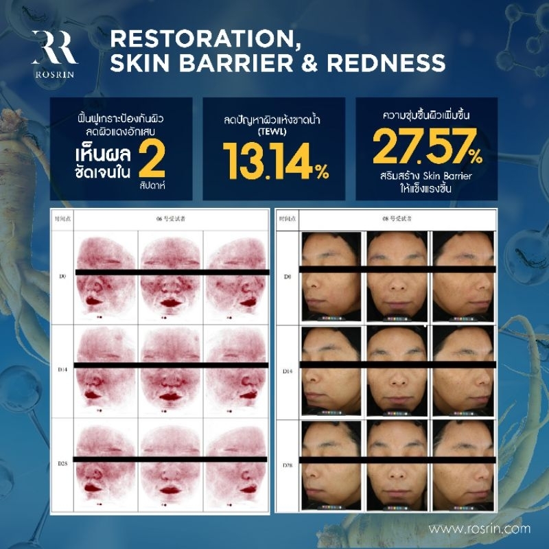 Chronoshen ® NEGT ช่วยฟื้นฟูผิวให้อ่อนเยาว์ขั้นสุด ให้ผิวแข็งมากขึ้น ผิวนุ่มชุ่มชื้น และลดรอยแดงได้ชัดเจน (ขนาด 25g,50g)