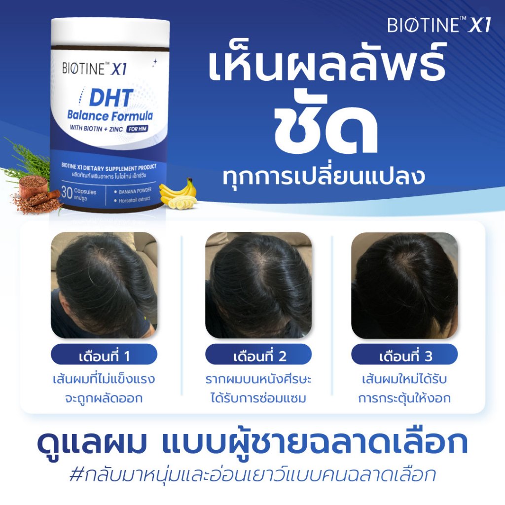BIOTINE X1 (ไบโอไทน์ เอ็กวัน) ซื้อ 6 แถม 2 กระตุ้นการงอก ผมแข็งแรง ร่วงยาก แก้ปัญหาผมบาง เถิก ล้าน - รูปที่ 6