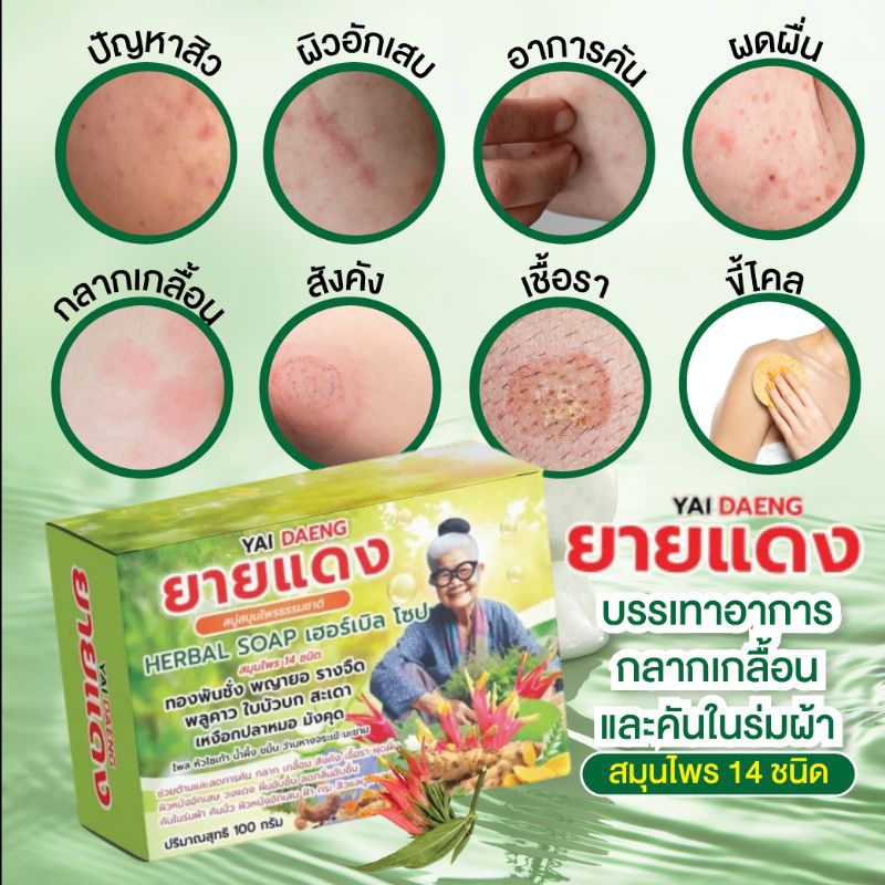 สบู่ยายแดง แก้คัน กลาก เกลื้อน สังคัง เชื่อรา ผุดผื่น ผิวหนังอักเสษ วงแดง