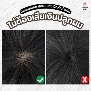วิกปิดผมบางผู้ชาย ตัดซอยเข้าทรงได้ปิดผมหงอก ปิดผมบาง ปิดหัวล้านไม่ต้องเสียเงินปลูกผม