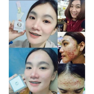ครีมชาร์มมิ่งสกิน Charming skin (ไนท์ครีมเล็ก ขนาด 10 กรัม) ส่งฟรี