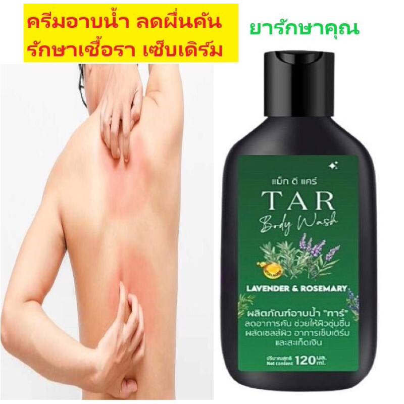 Mag D care ครีมอาบน้ำ ลดผื่นคัน กลาก เกลื้อน เซ็บเดิร์ม 120ml