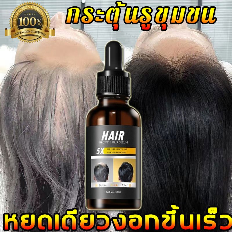 ปลูกผมเร็วบอกลากับหัวล้าน ZHIQI เซรั่มปลูกผม สเปรย์ปลูกผม ปลูกผม น้ำยาปลูกผมชาย น้ำยาใส่ผม ยาปลูกผมของแท้ ปลูกผมเร่งด่วน