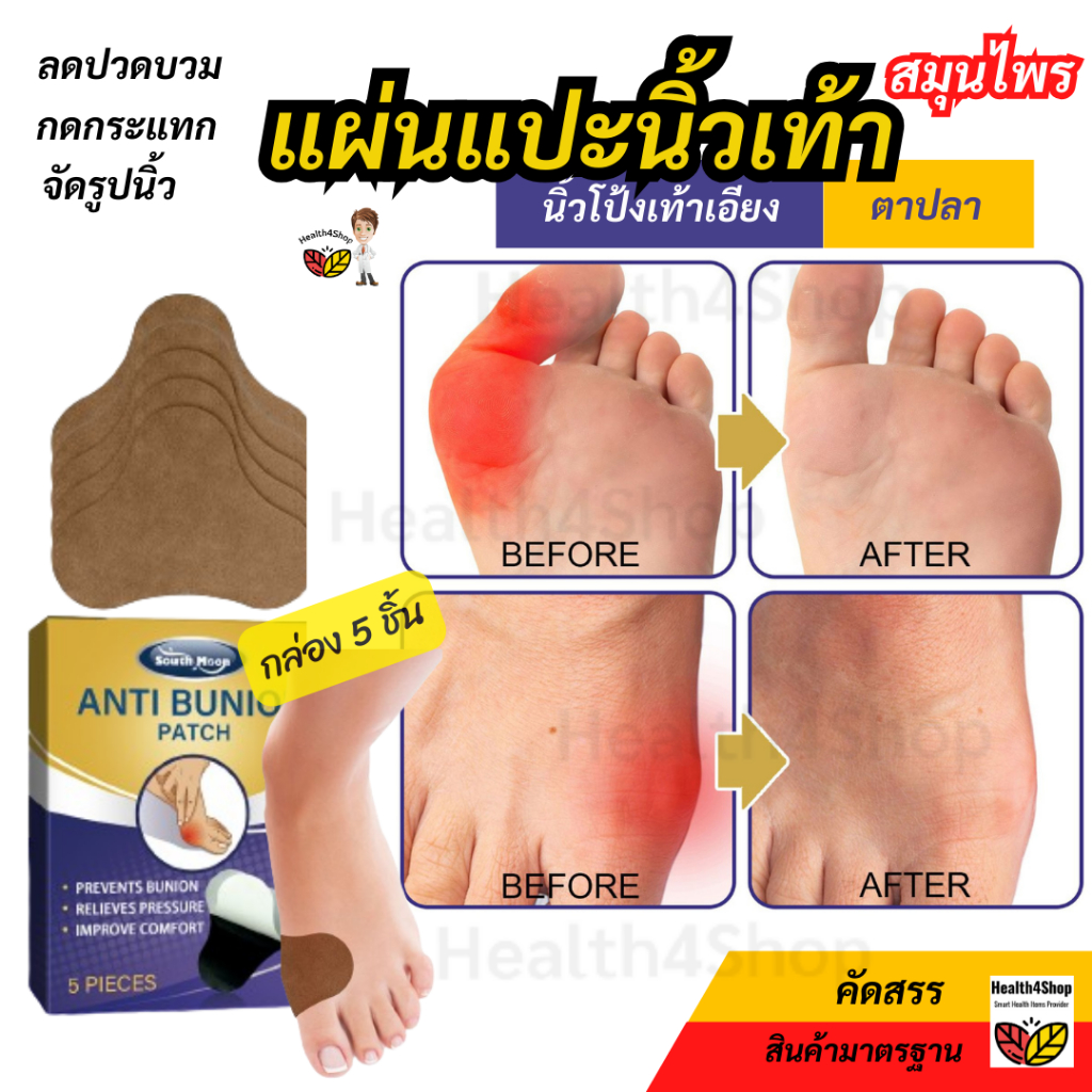 P58 South Moon แผ่นแปะนิ้วโป้งเท้าเอียง ป้องกันตาปลา ลดปวดบวม กันเสียดสี ดึงนิ้วกันเอียงเพิ่ม จัดรูปนิ้วเท้า