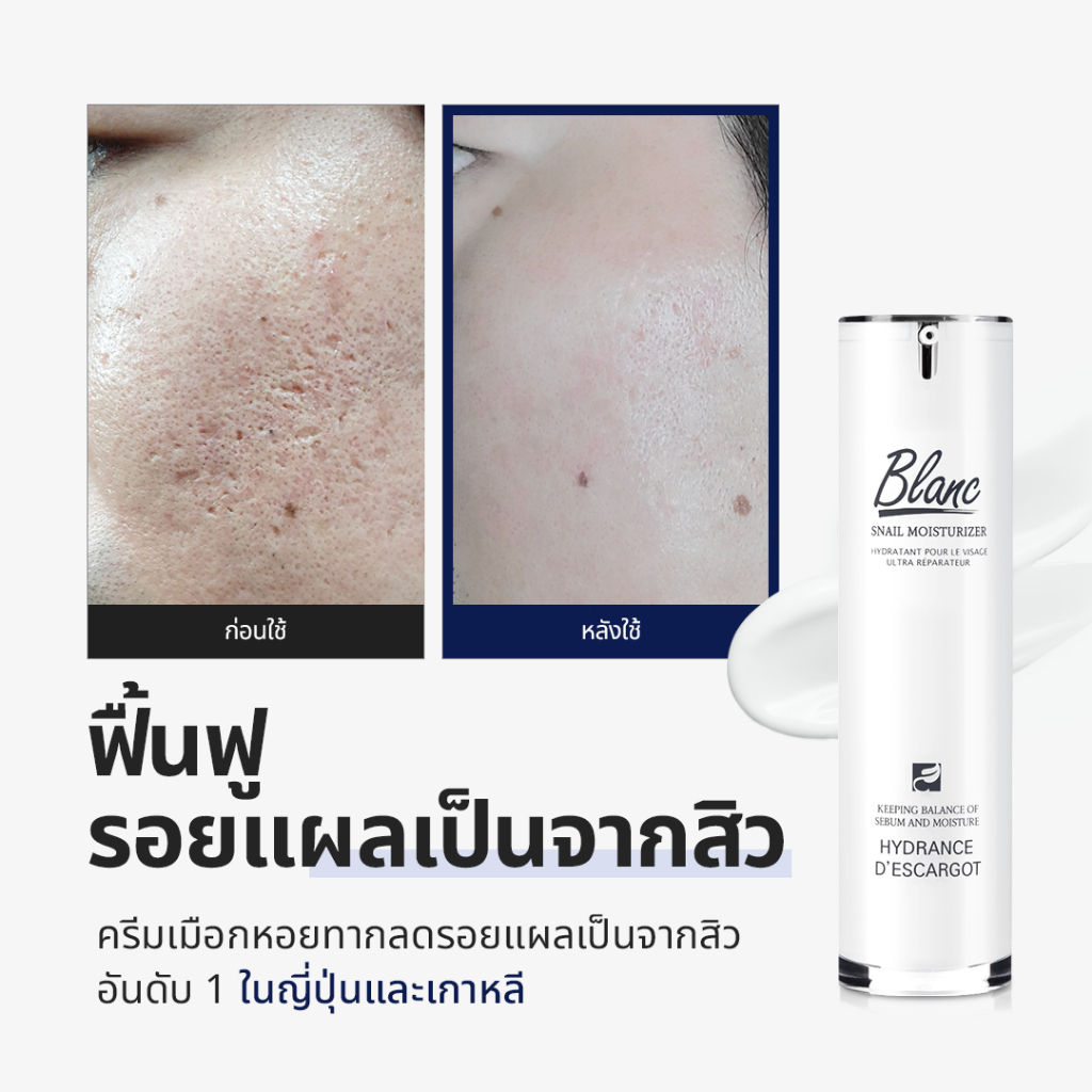 [Blanc Nature Official] มอยซ์เจอไรซิ่งครีมรักษารอยจากสิว ขายดี *อันดับ 1* สกินแคร์เกาหลี K-beauty