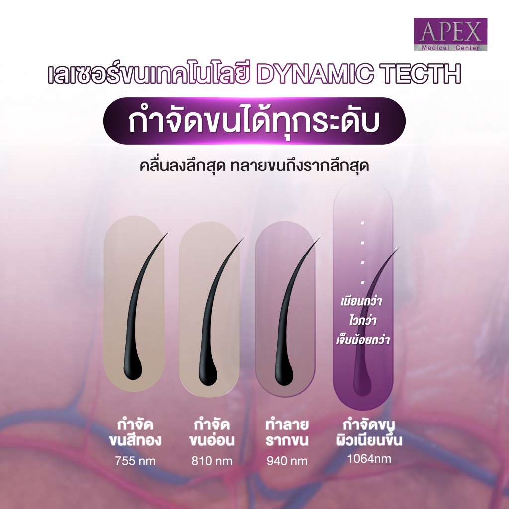 [E-Voucher] APEX เลเซอร์ขนหน้า ทั่วหน้า หนวด เครา คาง  ราคาพิเศษเฉพาะทดลอง 1 ครั้ง