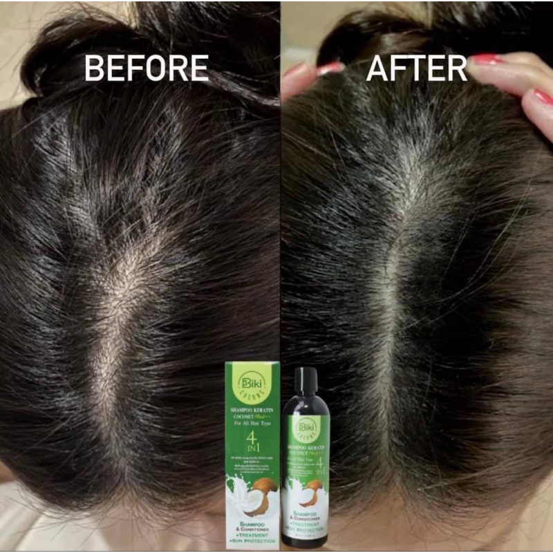 แชพู+เซรั่มขาว-ใช้บำรุงผมสามารถสระผมได้ทุกวันในกล่องมีสูตรและวิธีการใช้ให้ครบจบ - รูปที่ 4