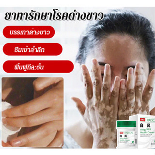 ยาทารักษาโรคด่างขาว ยาทารักษาโรคด่างขาว การดูแลผิว ด่างขาว ครีมสมุนไพรจีน ด่างขาว เกลื้อนน้ำนม จุดขาว กระขาว สีผิวไม่เสม