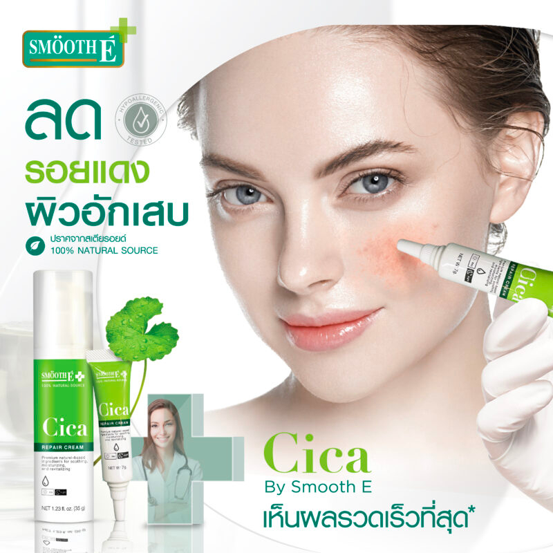 Smooth E Cica Repair Cream ลดรอยแดง ผิวอักเสบ ลดอาการผิวแพ้ง่าย แก้ปัญหา หลุมสิว ผิวแห้งเป็นขุย